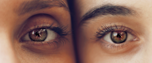 Read more about the article The Cataracts of Our Spiritual Life